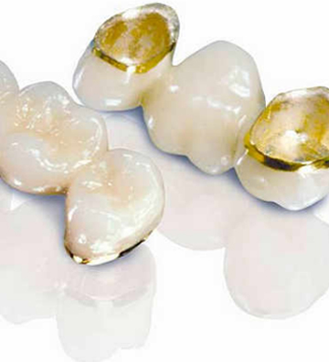 Протезирование зубов